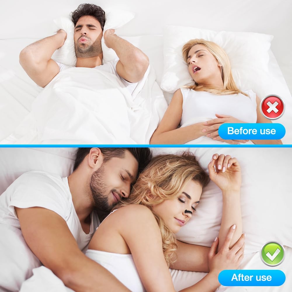 Full-Set (4 sizes nose strips + 30 Days intakes pack for free)