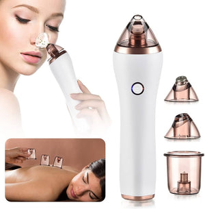 Netflip™ Blackhead Remover Device
