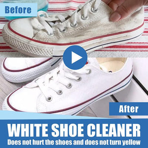 The Only Authentic Magic Shoes Whitening Cream in Lebanon — Confidence in Seconds.